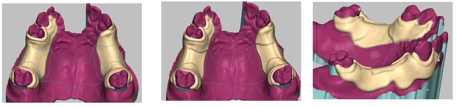 HP用3Ｄエステﾌﾟﾚｾﾞﾝ画像3