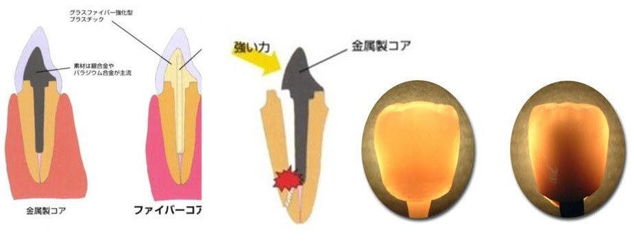 HPﾌｧｲﾊﾞｰﾎﾟｽﾄ3
