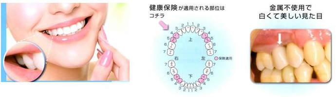 処理済HP用CADCAMﾊｲﾌﾞﾘｯﾄﾞ