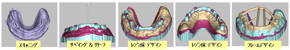 処理済HP ﾊｰﾀﾞｰ ﾊﾞｰ