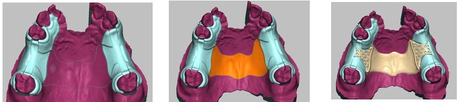HP用3Ｄエステﾌﾟﾚｾﾞﾝ画像4