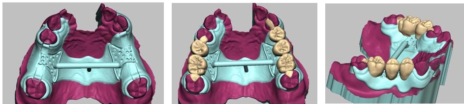 HP用3Ｄエステﾌﾟﾚｾﾞﾝ画像5
