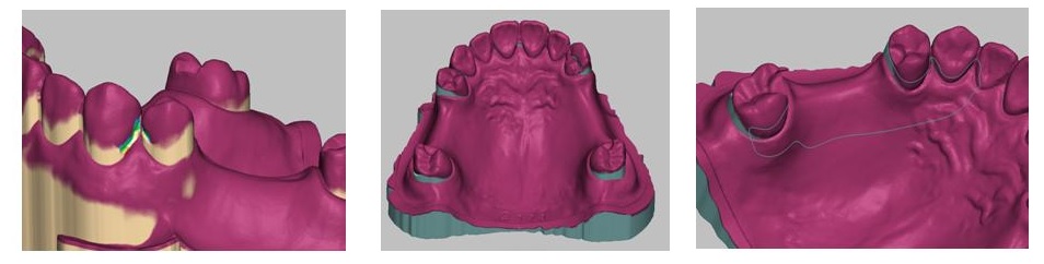 HP用3Ｄエステﾌﾟﾚｾﾞﾝ画像2